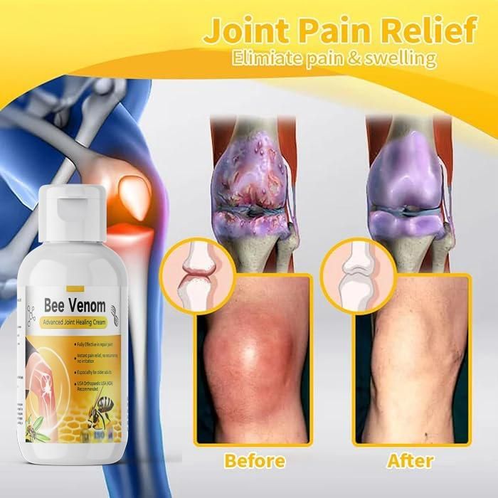 Bee Venom Advanced Joint Healing Cream 400 gm Pack of 2